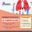 Formation sur la tuberculose à Namur